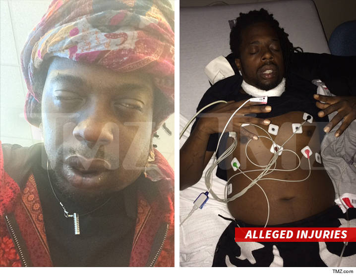 0624-detail-injuries-tmz-6