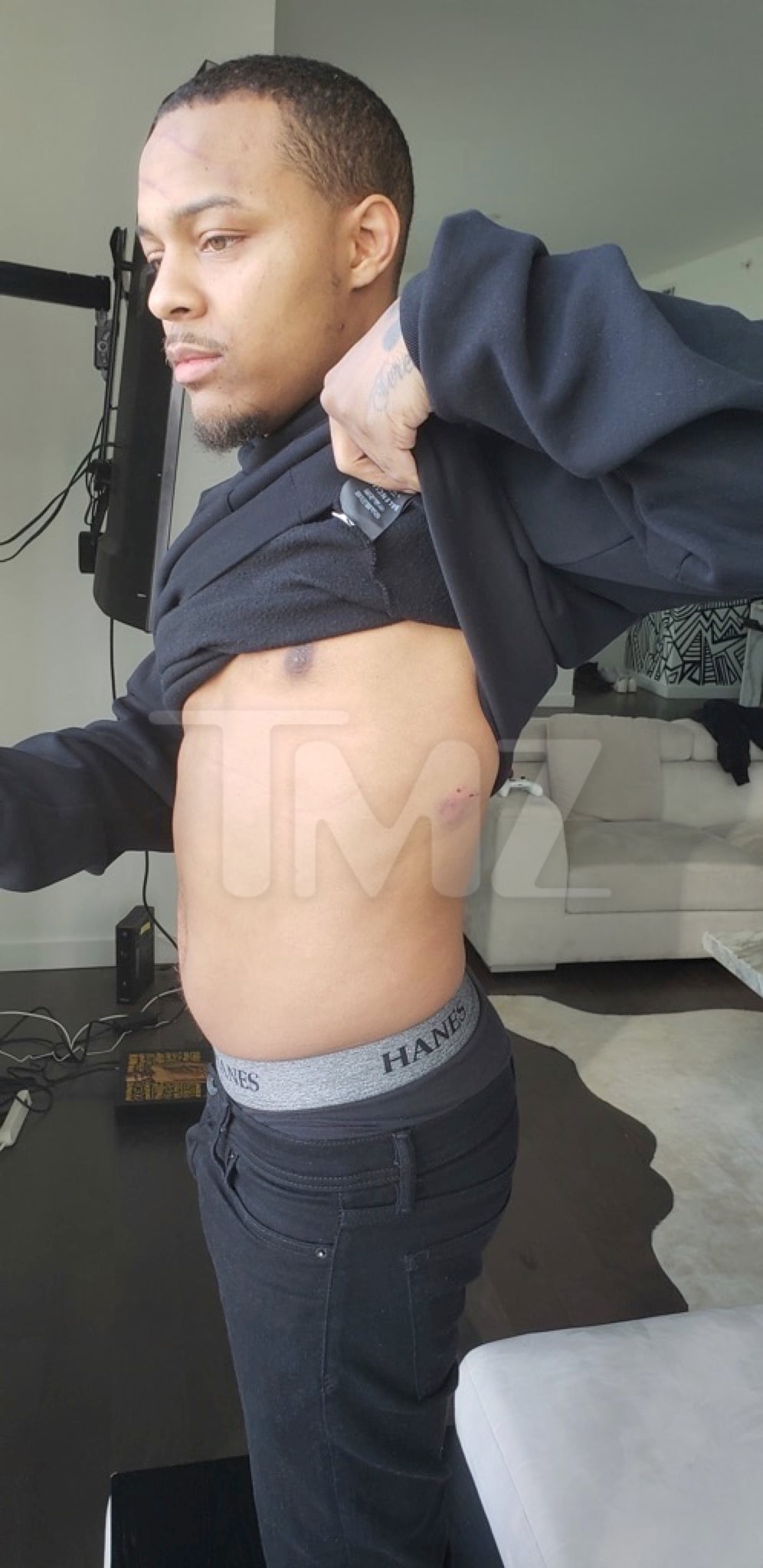 Bow Wow Domestic Violence Injuries